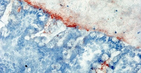 Coupe histologique de tissu intestinal humain immuno-marqué pour la bêta-défensine-3. La bêta-défensine-3 est en rouge, l’épithélium est en bleu, la lumière intestinale est en gris. Crédit : Brice Sperandio/Institut Pasteur