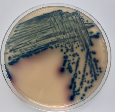 Colonies d’Escherichia coli sur gélose chromogène, © Bourles Alexandre